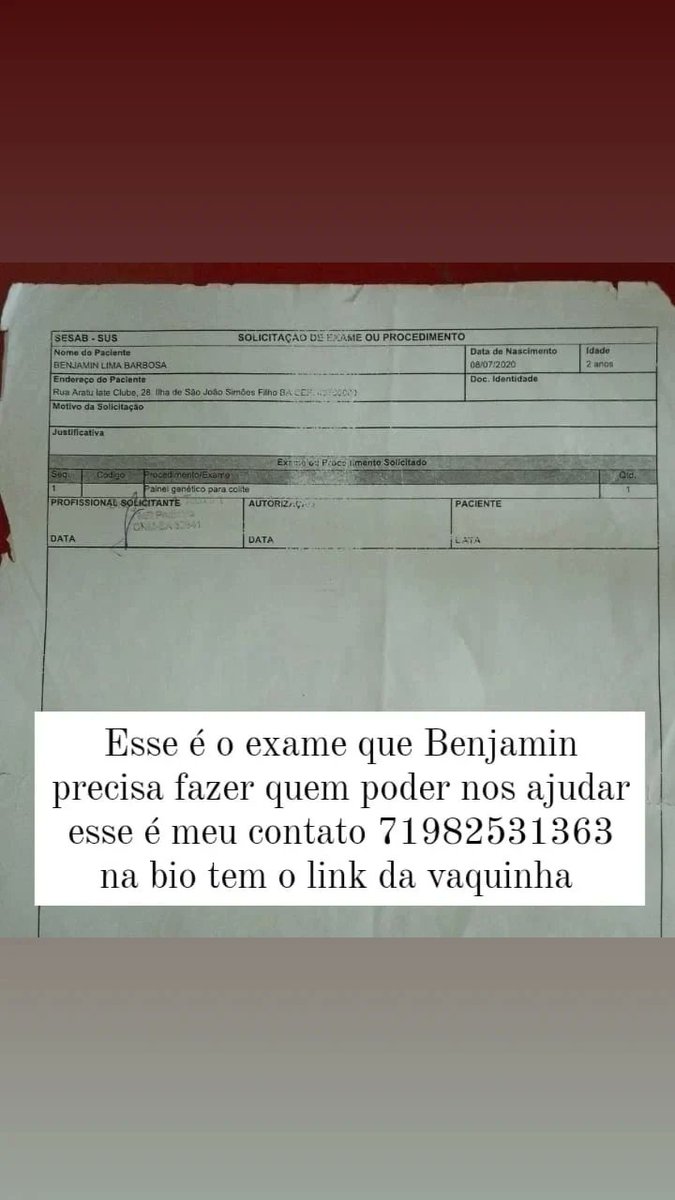 #LulaGovernoDeTodos ajude meu filho realizar exame painel genético para colite que não faz no SUS ele autista cardioco imunodeficiência tem diarréia crônica com sangue desde 29dias de vida crises de vomito,sangramento pelo pé dos dentes,pix 71982531363 ou vakinha.com.br/3009548
