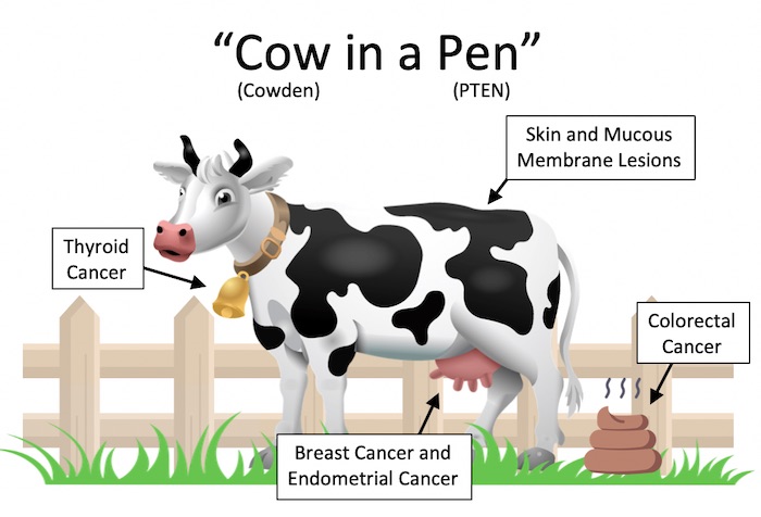 OperativeReview's tweet image. Useful mnemonic to remember the presentation of Cowden Syndrome:

operativereview.com/pten-hamartoma…

#MedEd #SoMe4Surgery #MedTwitter