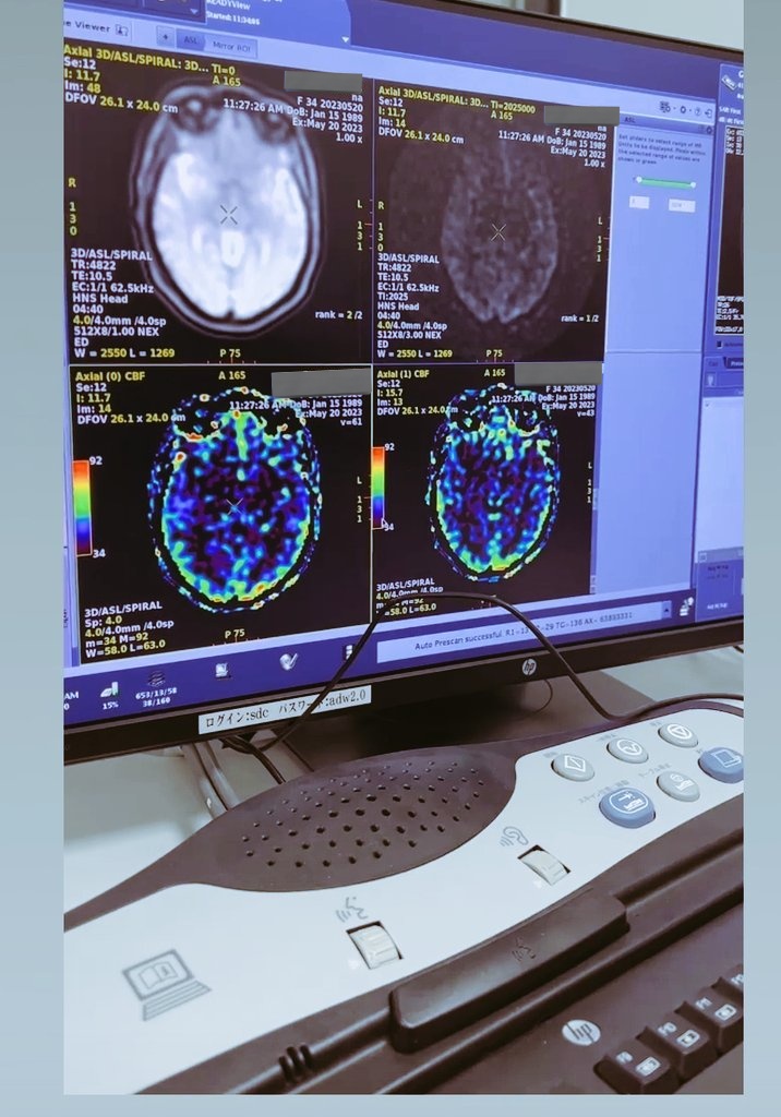 Өнөөдөр MRI.н сургалт маань явагдаад бараг л эхлүүллээ дээ. 
Манай MRI уншдаг дүрсийн эмч маань японд тархины MRI.н судалгаагаар доктор хамгаалаад ирсэн мундаг эмч байгаа. Аутизмын үеийн нарийн оношилгоо хийх сонирхолтой байгаа ирээдүйд 😉