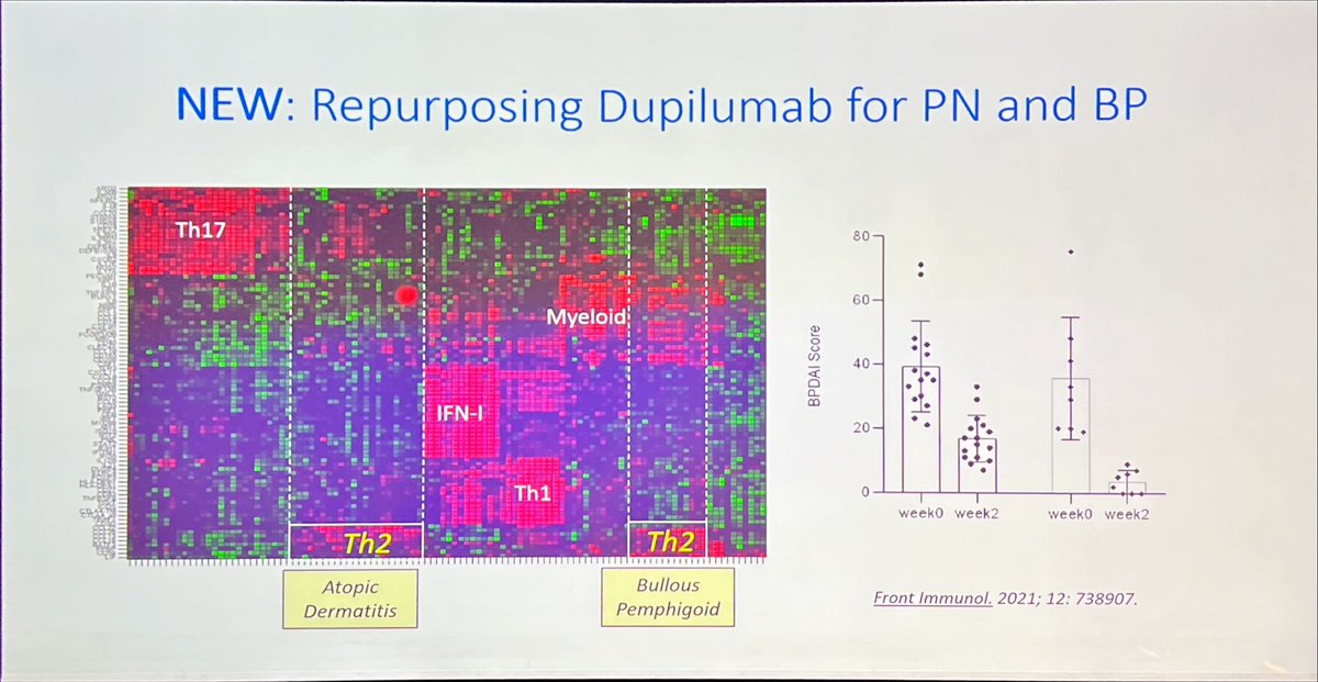 Joanna Goldberg MD 🇮🇱 (@drjoannagold) on Twitter photo Repurposing #dupilumab for #bullouspemphigoid <a href="/MGilliet/">Michel Gilliet</a> at #eadvsymposium: not surprising when we look into #immunology Repurposing #dupilumab for #bullouspemphigoid <a href="/MGilliet/">Michel Gilliet</a> at #eadvsymposium: not surprising when we look into #immunology