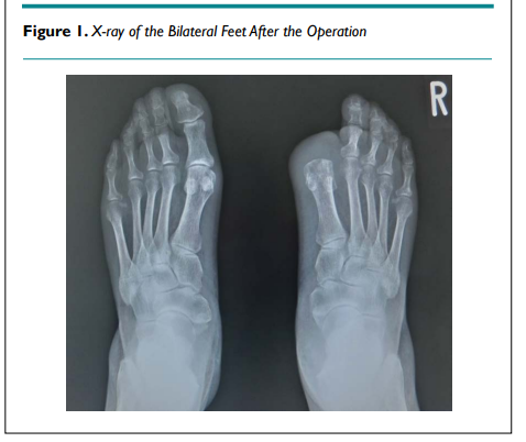 DROpenJournal's tweet image. Profile of Blood Glucose in Diabetic Patient Suffered from.....by Hiroshi Bando, MD, PhD, FACP [ISSN 2379-6375]

📖Read the full article here: bit.ly/3itHwug

Click here to submit the manuscript: bit.ly/3GNx61Q

#openventio #OpenAccess #DFI #LCD #DFO #IWGDF