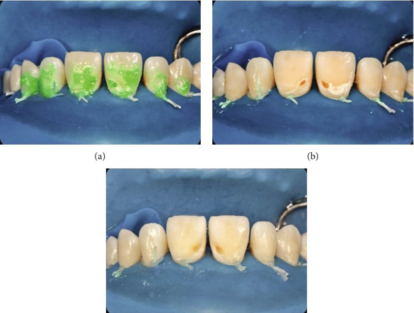 Dr.Bandar tweet media