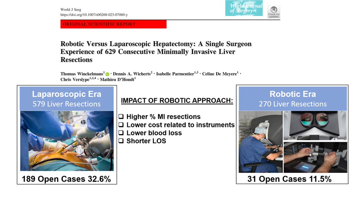 My series of MI liver resections (lap and robotic) from @azgroeninge just published in @WorldJSurg . A 🪞 Thx to all the 🔝nurses and anesthesiologists. @IHPBA @ILLS_LAPLIVER @8500Kortrijk @orsiacademy enjoy: rdcu.be/dcyAP