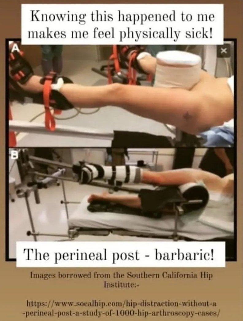 @annasylwestrowi @Sindi08080 @US_FDA @GovCanHealth I have in the UK, there has been no support.

My clitoris was crushed against my pubic bone during a non-urgent  #hipArthroscopy for a hip impingement. I was 34.

I was not advised of the KNOWN risk of damage to sexual function from the use of the #perinealpost

#wilfulneglect