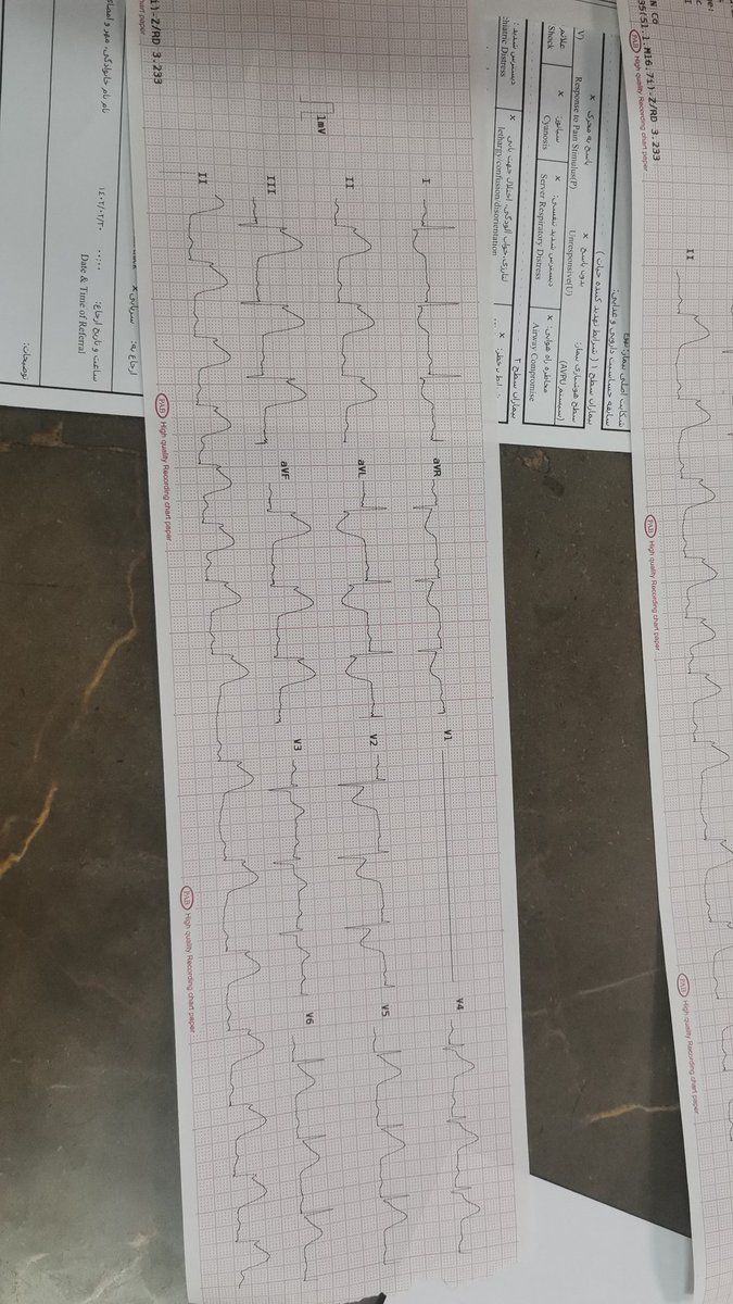 haloperidooll's tweet photo. ساعت 5 صبح نشستی تا شیفتت تموم بشه، یکی میاد میگه دیشب باقالی پلو خوردم و از بعدش دارم آروغ میزنم. میگی درد قفسه سینه داری؟ میگه نه.
حالا نوار قلبش : https://t.co/YyuR5ipmVG