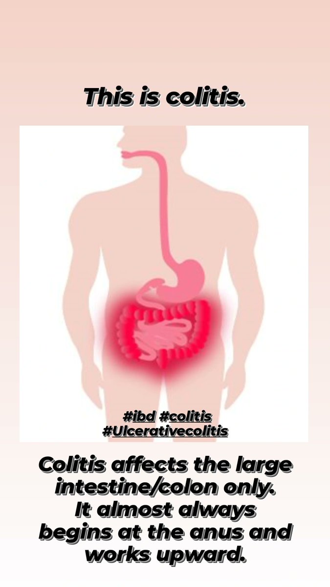 Do you know the difference between crohn's and colitis?
#ibd #ibdawareness #CrohnsDisease #colitis #ulcerativecolitis