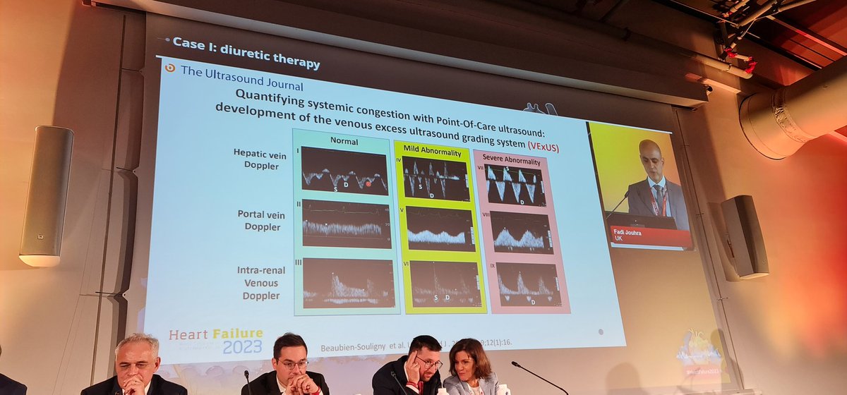 Casos clínicos de Insuficiencia Cardíaca aguda, donde los expertos aconsejan trabajar en equipo por el bien del paciente. #HeartFailure2023