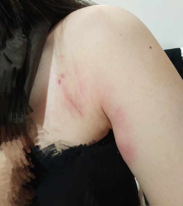 ショットガンの反動で痣できた😇
うまくなったら痣出来ないようになるんだろうか… 