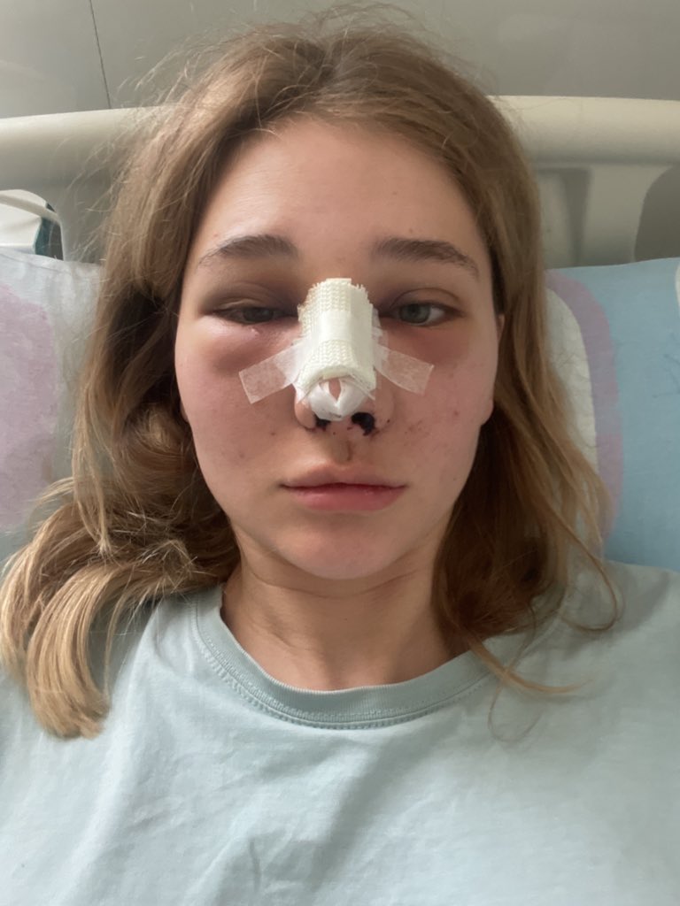 🇮🇱 двачеоля инцельская 🕎 on Twitter: "прошел ещё один год. лицо другое ...