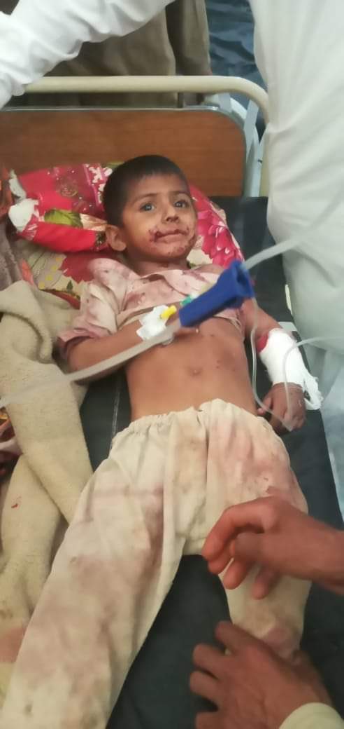 ManzoorPashteen's tweet photo. ضلع ٹانک کڑی حیدر میں ظالم فوج کی فائرینگ سے زخمی ہونے والہ محمد والد باطن خان۔
میں چیلنج دے کر کہتا ہوں کہ باطن خان یا اسکے خاندان کے کسی رکن کا دھشتگردی سے کوئی تعلق نہیں ہے۔
مگر یہ ایک واضح حقیقت ہے کہ ریاست کی اپنی پیداوار دھشتگردی کی آڑ میں پشتون قوم کی نسل کُشی جاری ہے۔ https://t.co/baJo3j0QtS
