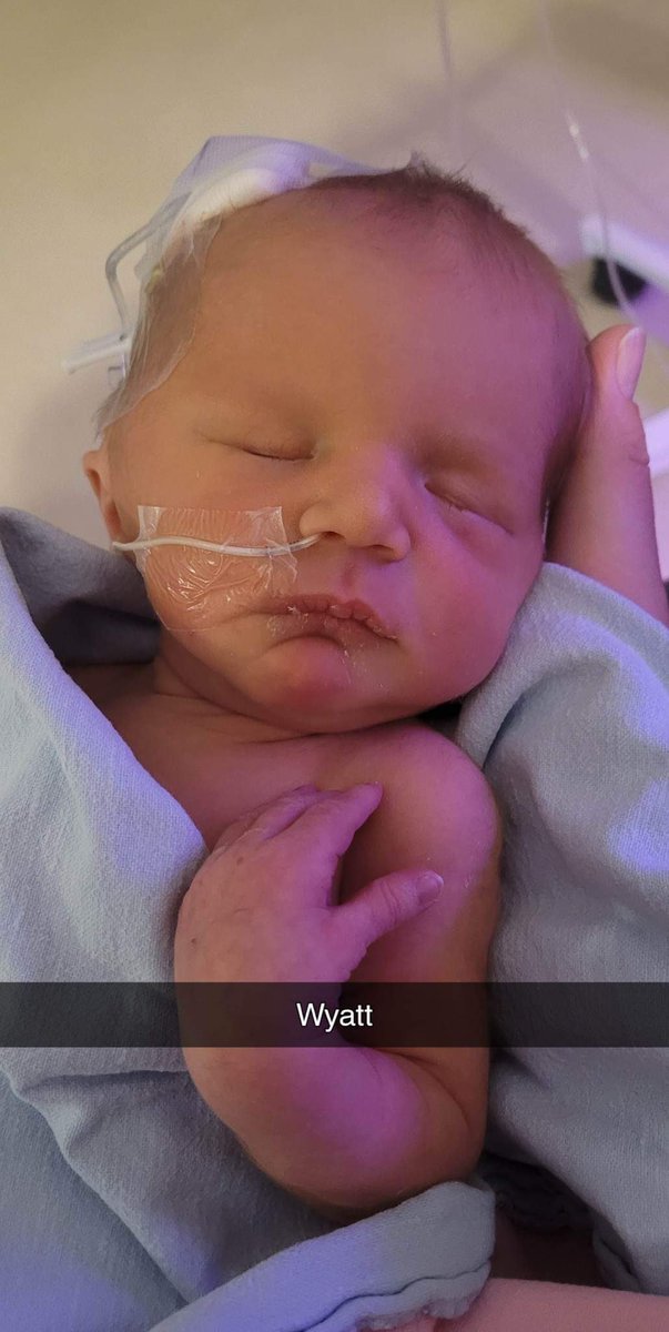 Today marks the first birthday of our SuperHero Wyatt. 
We ask that you keep his family close in your hearts today, as they honour their beautiful baby boy.
Happy Heavenly Birthday Wyatt. 💙