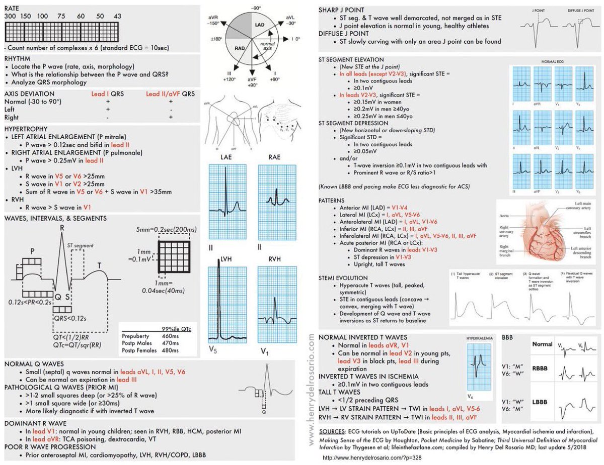 ECG interpretations