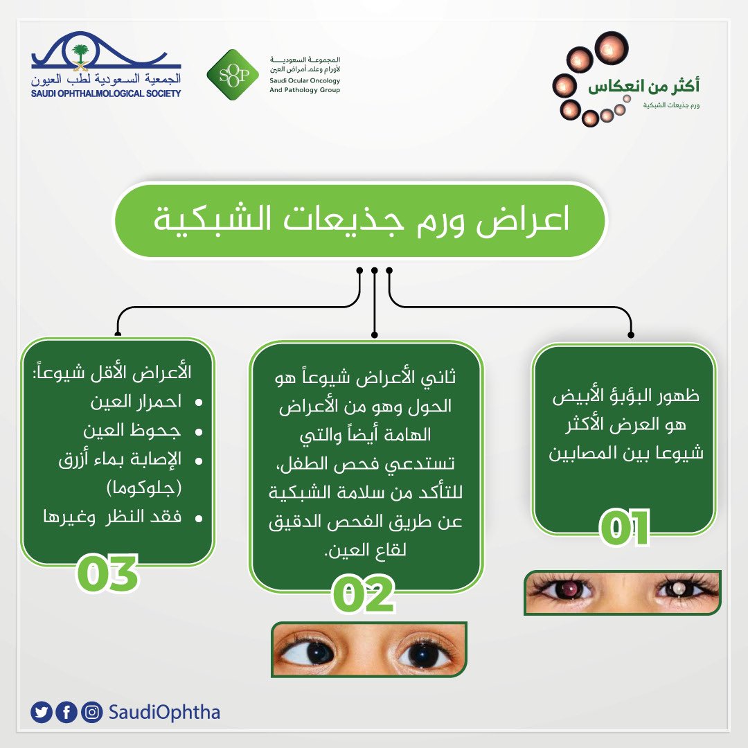 الجمعية السعودية لطب العيون SOS tweet media