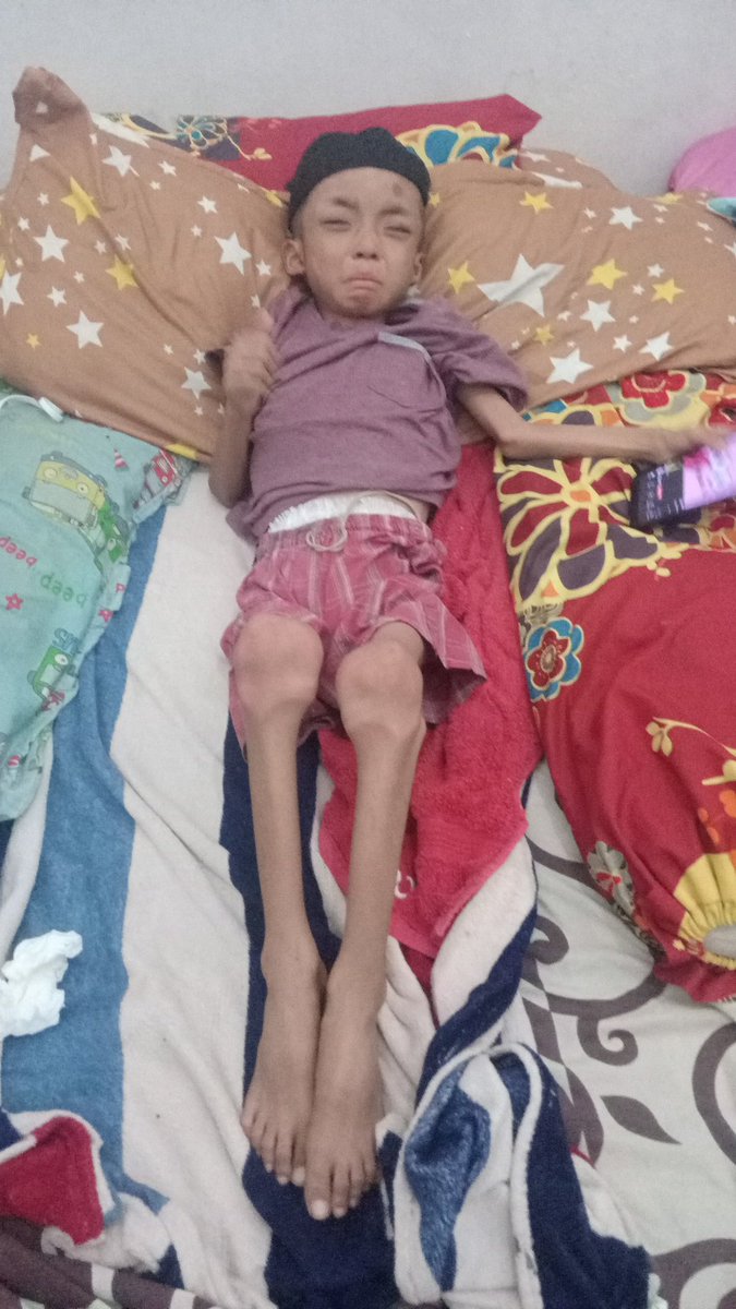 ekoblora77's tweet photo. Ini anak saya Vero yg sedang sakit Pak, sekali lagi saya mohon jgn padamkan aliran listrik rumah saya Pak https://t.co/q897kXQhNN