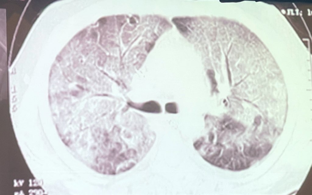 M Velia Antonini tweet media