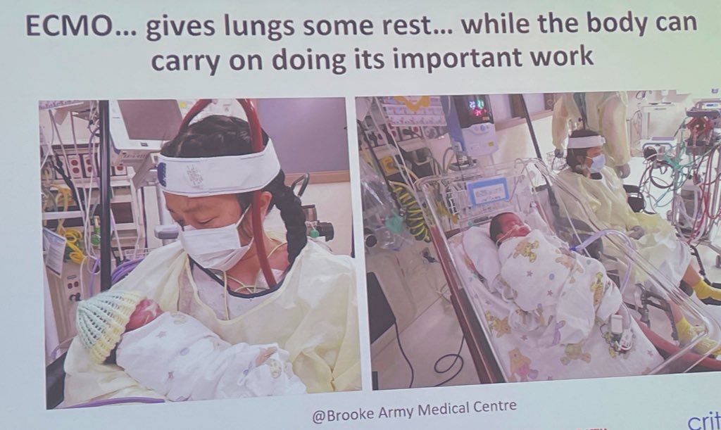M Velia Antonini (@foamecmo) on Twitter photo #ECLS in respiratory failure?? To protect the broken lung of patients with #ARDS. Do NOT forget the basics during the run: measures of protective mechanical ventilation & prone positioning are effective even during VV #ECMO. And, when it's time:
⬇️ neuromuscular blocking agents #ECLS in respiratory failure?? To protect the broken lung of patients with #ARDS. Do NOT forget the basics during the run: measures of protective mechanical ventilation & prone positioning are effective even during VV #ECMO. And, when it's time:
⬇️ neuromuscular blocking agents