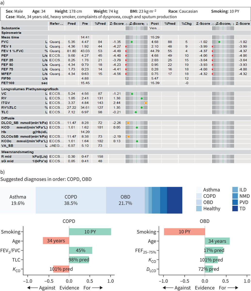 ERSpublications's tweet photo. ERJ: This study demonstrates that pulmonologists improve their individual diagnostic interpretation of pulmonary function tests when supported by AI-based computer protocols with automated explanations. Such teamwork may become commonplace in the future. https://t.co/3CDL1egHcQ https://t.co/OELbbtMVLR
