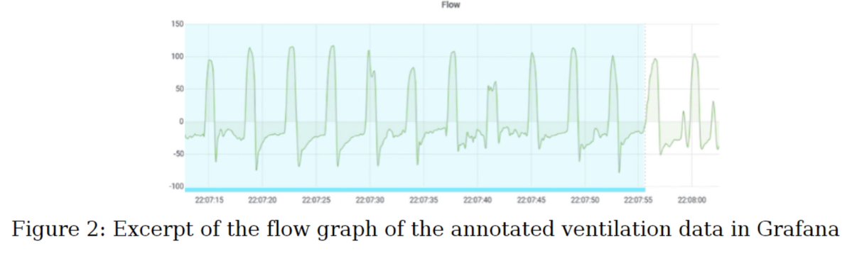 Today at <a href="/EFMI/">European Federation for Medical Informatics</a> #MIE2023 at 10:30h in Room G3:
(Sessions starts at 10:00h)

<a href="/BColdewey/">Beatrice Coldewey</a>, <a href="/RainerRohrig/">Rainer Röhrig</a>, <a href="/MyriamLipprandt/">Myriam Lipprandt</a>  (<a href="/RWTH/">RWTH Aachen</a> / <a href="/UniklinikAachen/">Uniklinik RWTH AC</a>):

Usability engineering of dynamic biosignal displays using ventilation data

DOI: doi.org/10.3233/SHTI23…