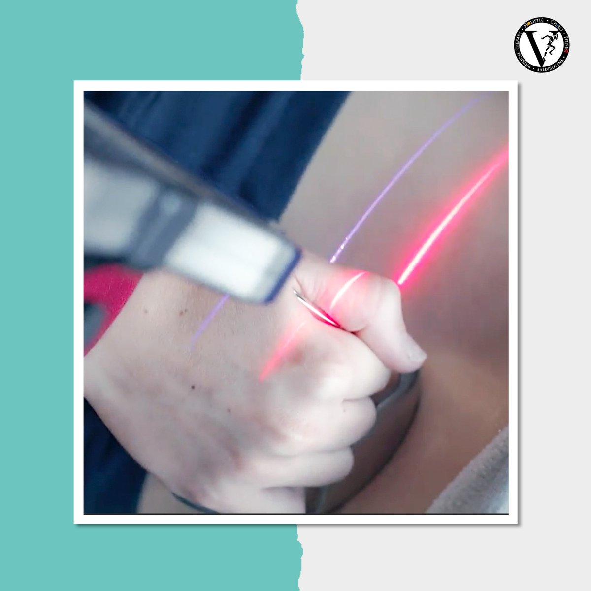 clubfivehealth's tweet image. Scar tissues are often ignored until it starts creating severe problems. Club5Five follows #Grastontechnique to provide sustainable healing for scar tissues.

#club5five #grastontherapy #painrelief #scartissuerecovery #TissueRegeneration #limitedrangeofmotion