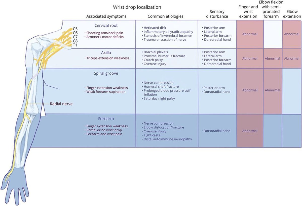 📍 localization and assessment of wrist drop 👌👇