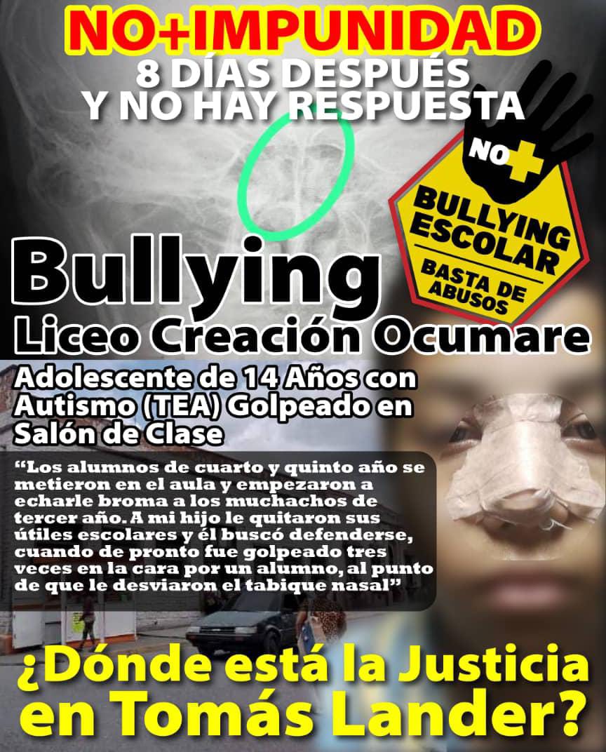 yoleidybb's tweet photo. @TarekWiliamSaab Saludos Fiscal General, este es un adolescente con autismo, que dos compañeros le desviaron el tabique nasal. Sus padres piden que el ministerio público inicie las investigaciones pertinentes. https://t.co/YslB3sVkFu