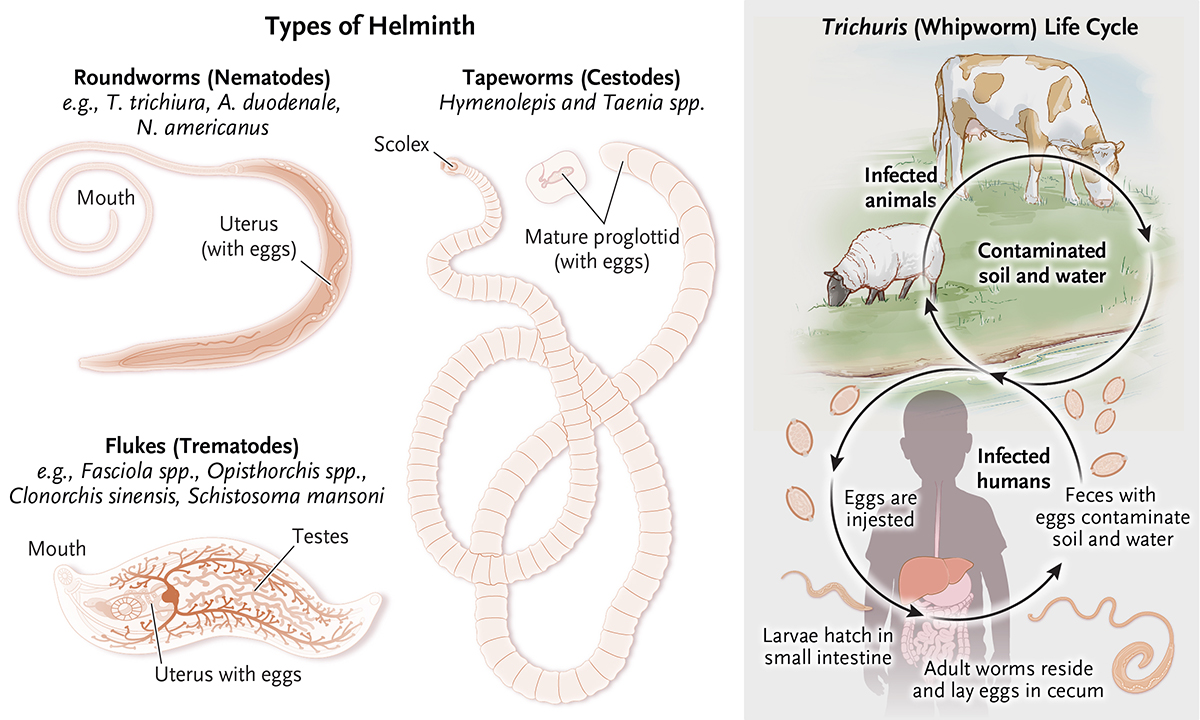 The Innovation Medicine on Twitter "RT NEJM Helminth Any member