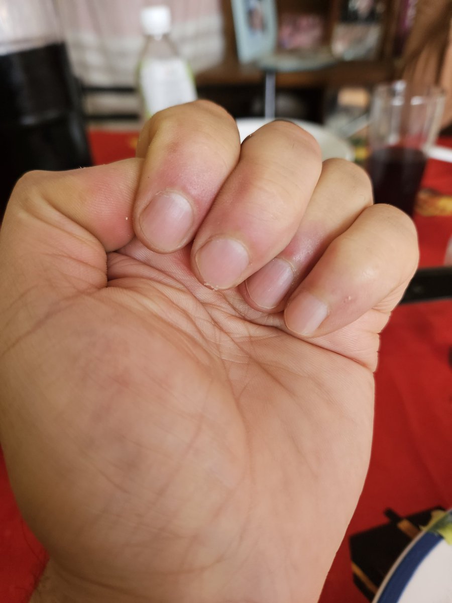 cgoexterno's tweet photo. @Coteee_martinez No ningún complejo. Es más es como los dedos de la mano todos de diferente tamaño pero son super unidos. 

Al final acostados son todos iguales https://t.co/GayRwFIzYE