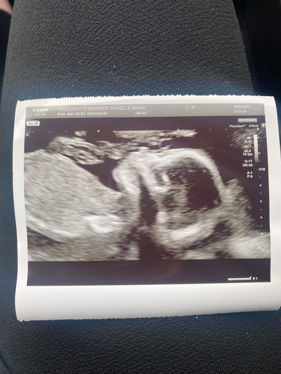 DanielleDM97's tweet photo. In the space of 4 weeks I found out I’m going to be a wife and a mummy to a beautiful baby boy❤️

2023 is surreal and forever grateful💕 https://t.co/vrO03OXMRq