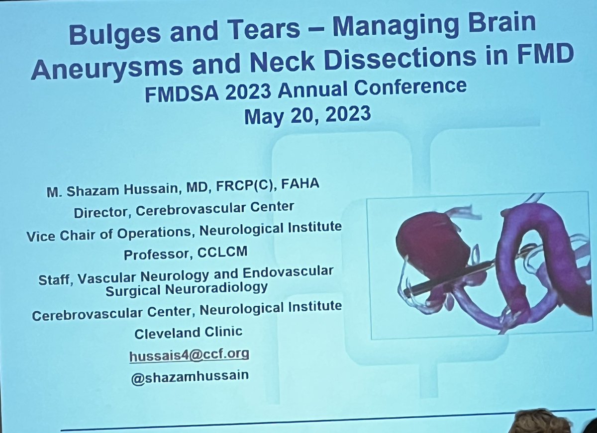 TabithaLobo's tweet photo. Excellent talk by @shazamhussain on “Bulges and Tears- managing brain aneurysms and dissections in FMD” about techniques and technologies in the world of vascular neurology #FMD #FMDSA @FMDartery  #vascularneurology #endovascular @pdmace2 @CLENeurons @ClevelandClinic https://t.co/35aAku5jmZ