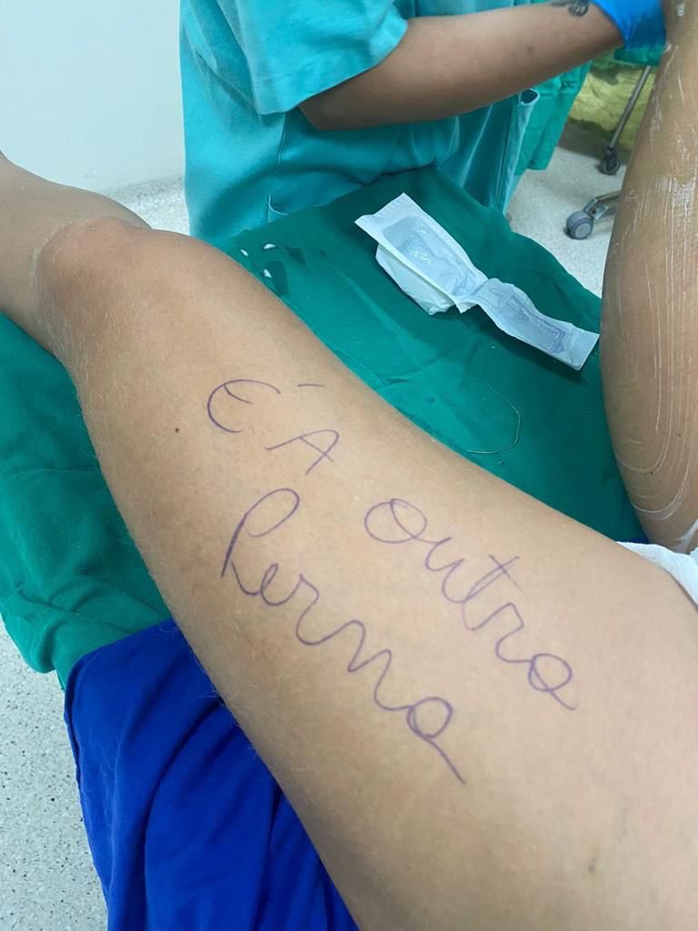🚨VEJA: Mulher vai fazer cirurgia na perna e faz escrita inusitada no membro.