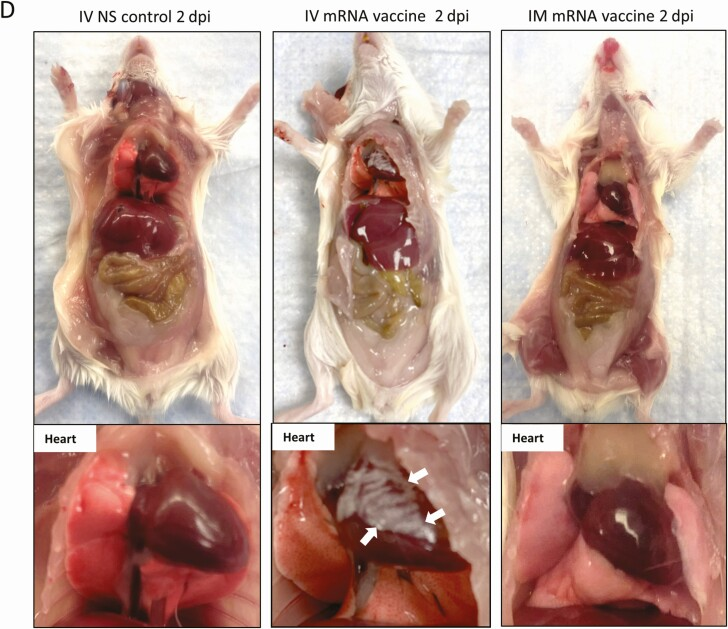 Intravenous Injection of #mRNA Vaccine Can Induce Acute Myopericarditis in Mouse Model
ncbi.nlm.nih.gov/pmc/articles/P…