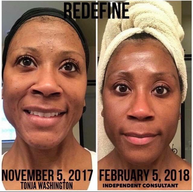 RFSkincareEnth1's tweet image. The results are in. ✔️

Our Redefine Regimen works 3x better, 2x faster on wrinkles and visibly lifts, sculpts + firms as it targets all signs of aging.

#RodanandFIelds #RedefineRegimen #BeforeAftersRF