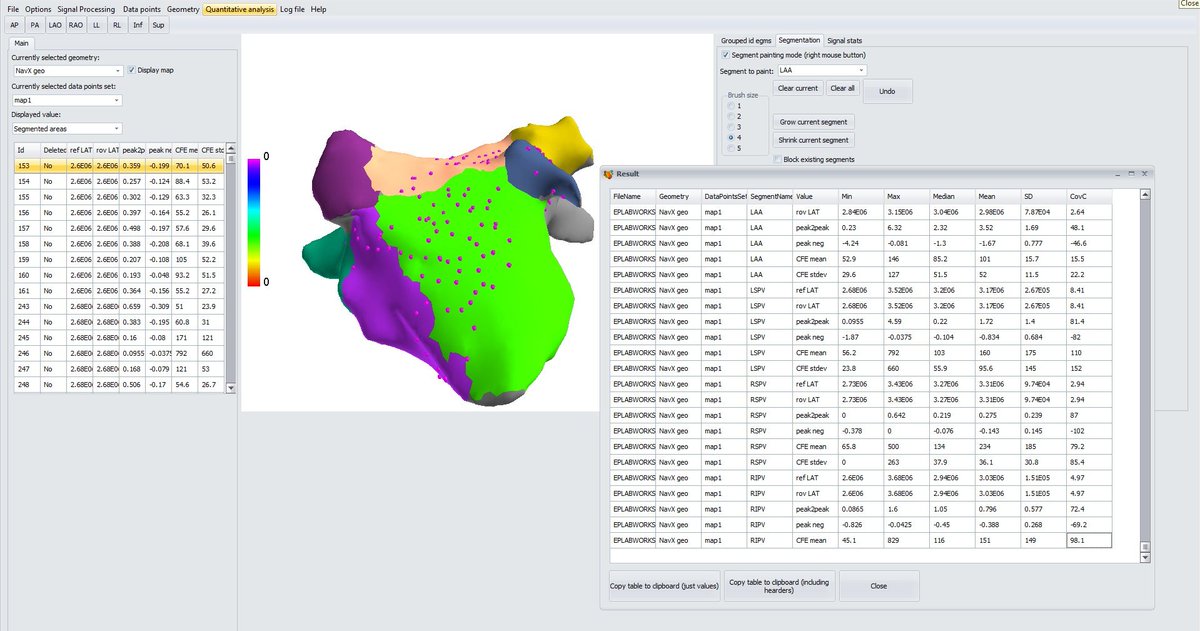 PawelKuklikPhd's tweet photo. Calling all cardiac electrophysiologists! 📢 Supercharge your research with our advanced app for 3D maps analysis. Uncover hidden patterns, explore novel techniques, and drive innovation in cardiac electrophysiology. Try it today! #EPResearch #ScientificTools #EPeeps https://t.co/ue8CQJEgkJ