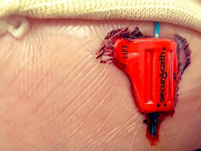 So sore today. 😩 https://t.co/umLoRDyfWp<a href="/tag/findom"class="tags"><span>#findom</span></a><a href="/tag/cuckoldhubby"class="tags"><span>#cuckoldhubby</span></a><a href="/tag/onlyfansgirl"class="tags"><span>#onlyfansgirl</span></a><a href="/tag/alphadominant"class="tags"><span>#alphadominant</span></a>