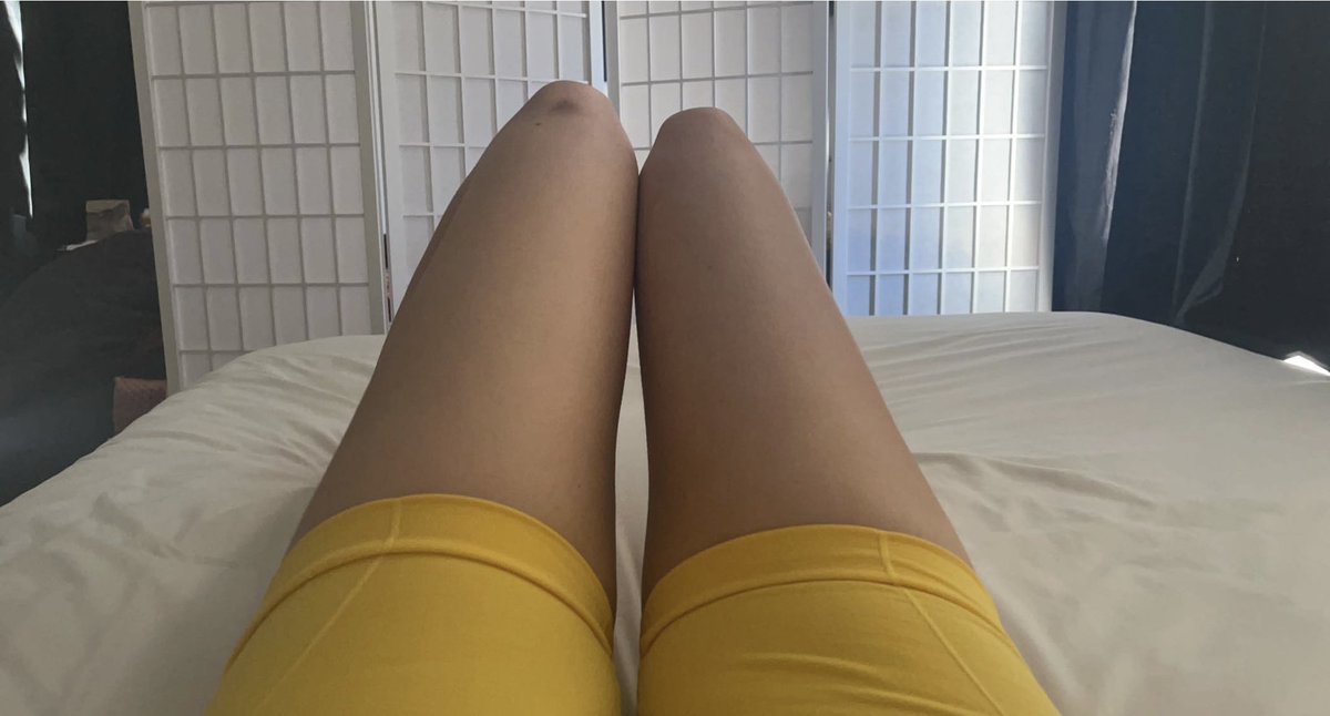 mirubunnie's tweet photo. exactly 1 year apart https://t.co/7OAlmryTOm