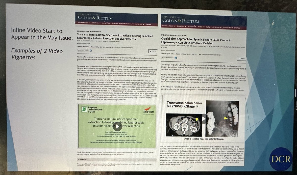 susan galandiuk (@dcredinchief) on Twitter photo Thrilling <a href="/DCRjournal/">DCRjournal</a> editorial board meeting this am. Thanks to our editors and readers, looking forward to valuable improvements and continued growth 👏
<a href="/JohnRTMonsonMD/">John Monson MD FRCS FACS FASCRS</a> <a href="/ScottRSteeleMD/">Scott R. Steele</a> <a href="/debby_keller/">Debby Keller, MD</a> <a href="/patsyllamd/">Patricia Sylla</a> <a href="/R_Perez_MD/">Rodrigo O Perez</a> <a href="/SeanLangenfeld/">Sean Langenfeld</a> <a href="/bolshinskyv/">Vladimir Bolshinsky</a> Thrilling <a href="/DCRjournal/">DCRjournal</a> editorial board meeting this am. Thanks to our editors and readers, looking forward to valuable improvements and continued growth 👏
<a href="/JohnRTMonsonMD/">John Monson MD FRCS FACS FASCRS</a> <a href="/ScottRSteeleMD/">Scott R. Steele</a> <a href="/debby_keller/">Debby Keller, MD</a> <a href="/patsyllamd/">Patricia Sylla</a> <a href="/R_Perez_MD/">Rodrigo O Perez</a> <a href="/SeanLangenfeld/">Sean Langenfeld</a> <a href="/bolshinskyv/">Vladimir Bolshinsky</a>