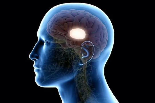 Concussion: Almost 50% Still Have Brain Injury after 6 Months: Concussion: many people struggle with long-term symptoms – including fatigue, trouble sleeping and concentrating, and emotional distress. Our study found changes in the way the thalamus tinyurl.com/2m925jur