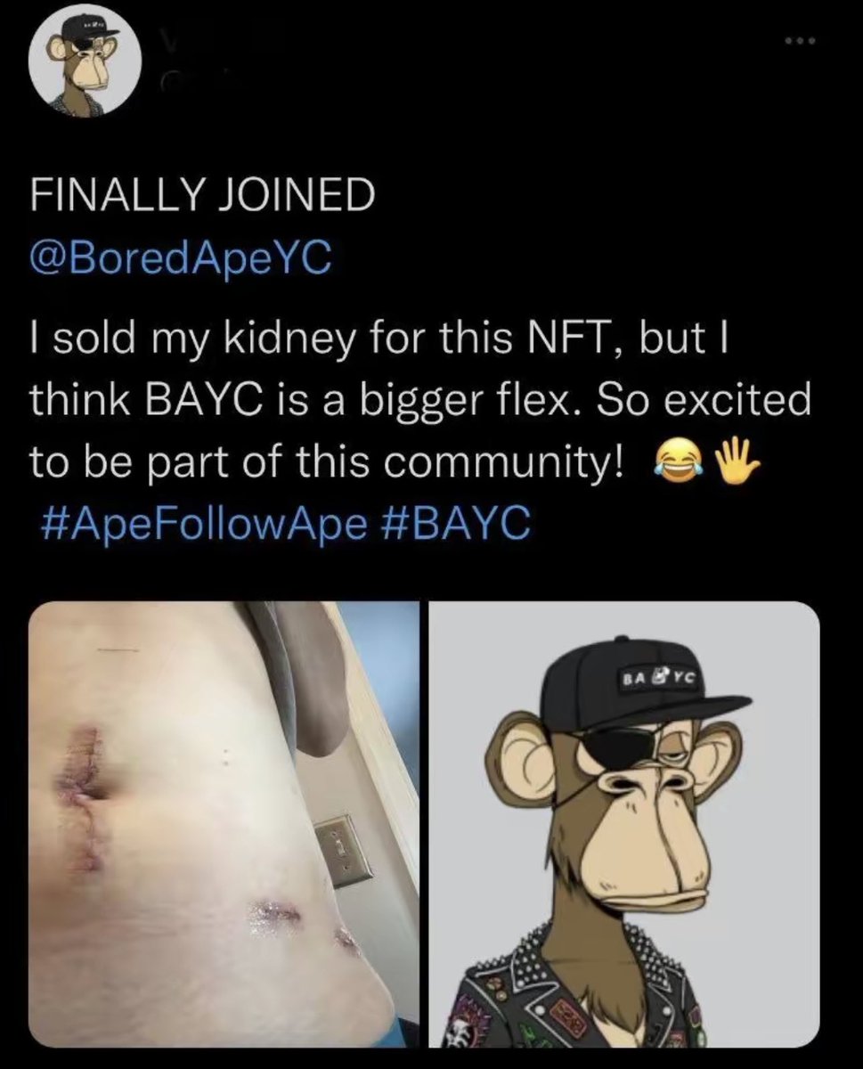 Braindead Bird App tweet media