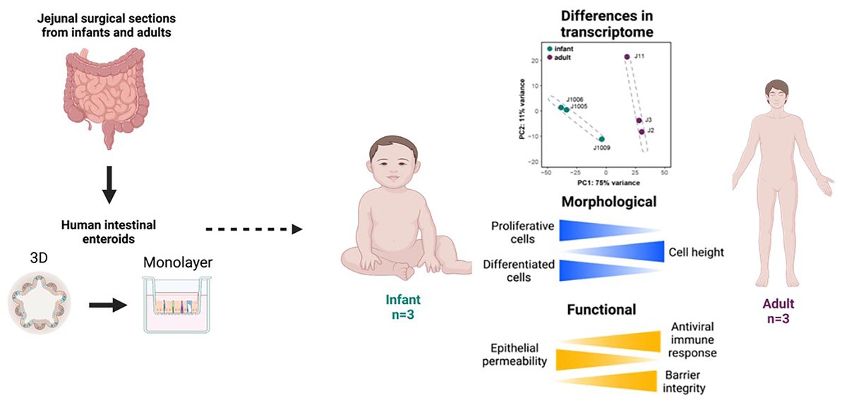sash_ramani's tweet photo. Excited to share the first preprint from the lab! We did transcriptomics, morphological characterization studies and functional studies to show that intestinal  #organoids from babies are very different from adults! https://t.co/A11cPh49Ab https://t.co/OrY68Bdu44