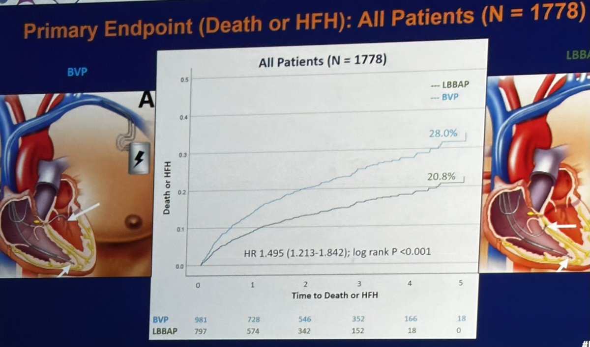 Dr Vijayaraman #HRS2023 late breaking trial: #LBBAP vs #CRT. - controlled non-randomized - 1,778 patients (!) - better echo response, better outcomes driven by HF hospitalization reduction - fewer complications