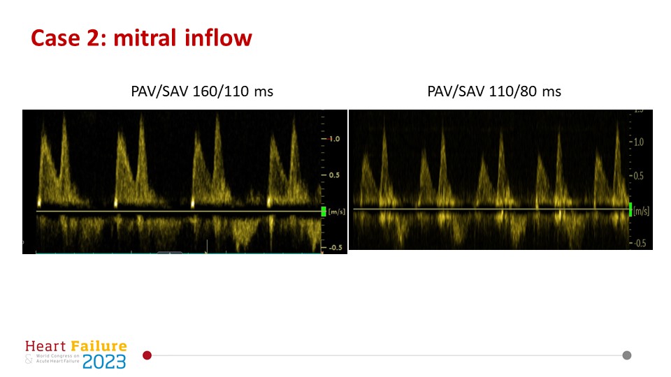 Jeroen Dauw On Twitter You Should Always Have A Look At What Happens jeroen-dauw-on-twitter-you-should-always-have-a-look-at-what-happens