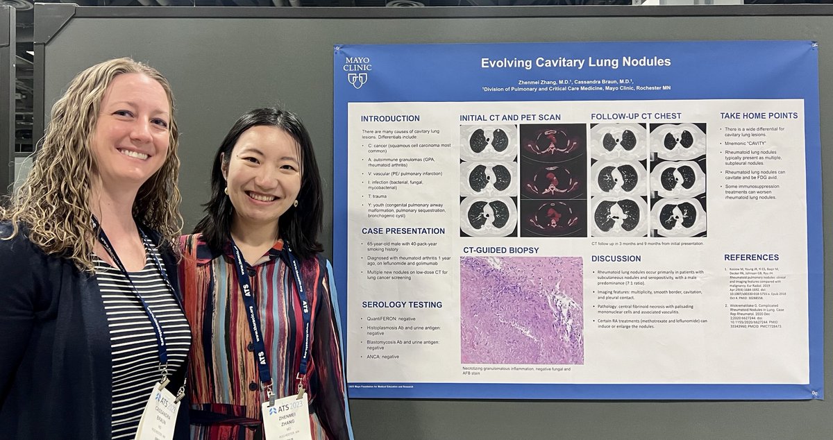 MayoPCCM (@mayopccm) on Twitter photo Third year <a href="/MayoPCCM/">MayoPCCM</a> fellow <a href="/ZhenmeiZhangMD/">Zhenmei Zhang</a> presenting her poster on a rare cause of #cavitarylunglesion at #ATS2023 <a href="/atsearlycareer/">ATS Early Career</a> <a href="/atscommunity/">American Thoracic Society (ATS)</a> Third year <a href="/MayoPCCM/">MayoPCCM</a> fellow <a href="/ZhenmeiZhangMD/">Zhenmei Zhang</a> presenting her poster on a rare cause of #cavitarylunglesion at #ATS2023 <a href="/atsearlycareer/">ATS Early Career</a> <a href="/atscommunity/">American Thoracic Society (ATS)</a>