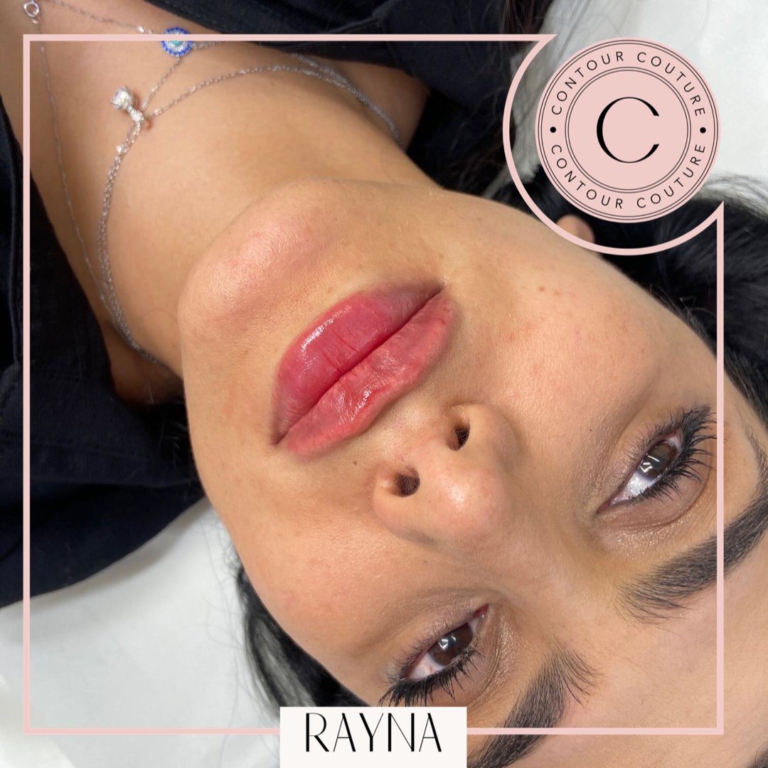 💖🌸What a beauty🌸💖

 #lipfillersswindon #lipfillersbristol #lipfillerscheltenham #lipfillersbath #revolax #perfectpout #fullerlips #dermalfillers #swindonbeauty #swindonbeautyclinic #bristolbeauty #aesthetics #bristollips #swindonaesthetics #bigliplove #lipfillers