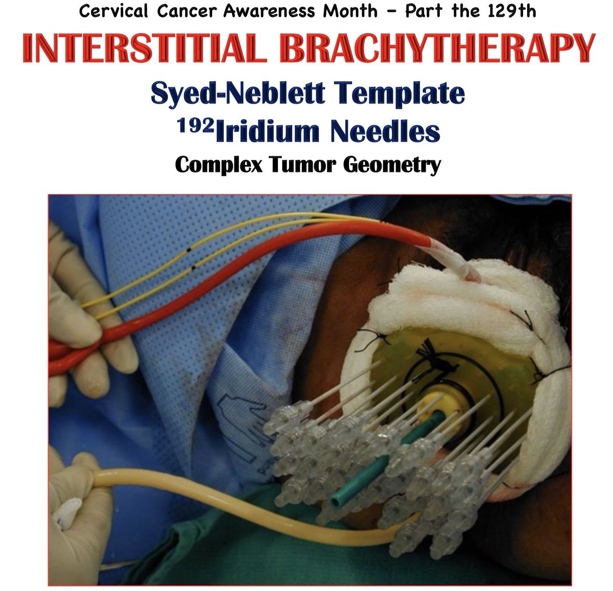 Krish Tewari, MD (@drtewari) on Twitter photo 