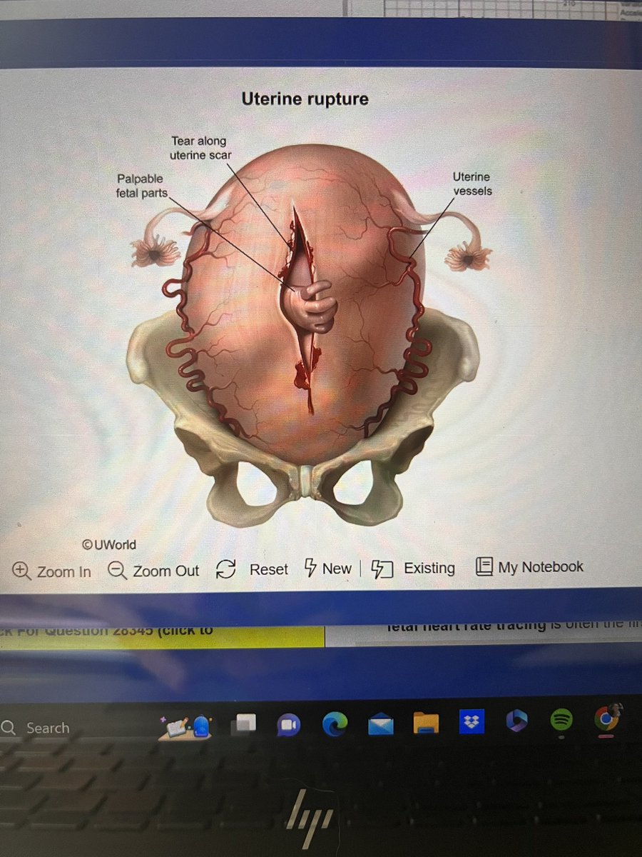 Amber_LeeOMS's tweet photo. I feel like this image is a right of passage for all medical students 🥲 https://t.co/yuULeyOMwO