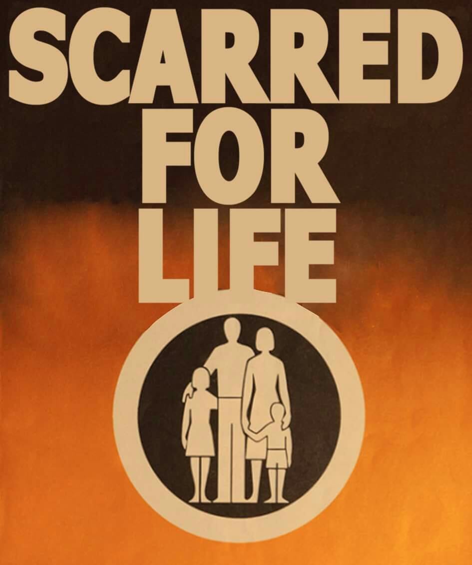 Scarred for Life tweet media