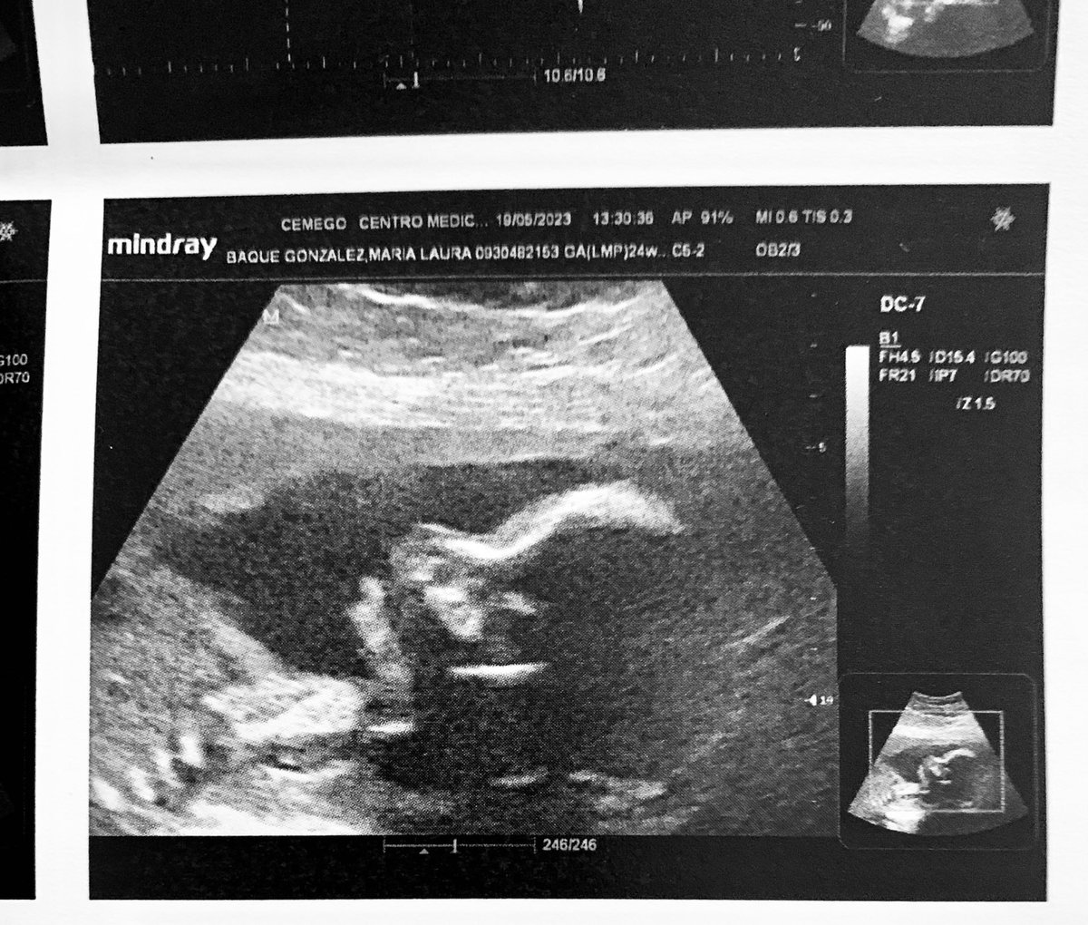 lbaque_2's tweet photo. Los hombres de mi vida, como me hacen feliz 💙💙🥹👶🏻. Te esperamos con ansias mi Paulito Alessandro. https://t.co/V9qQbkxjTq