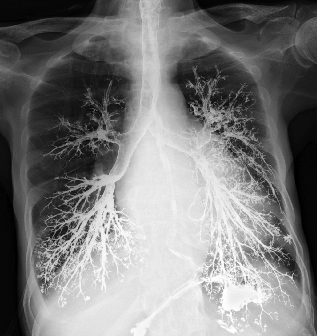 NephroPOCUS tweet media