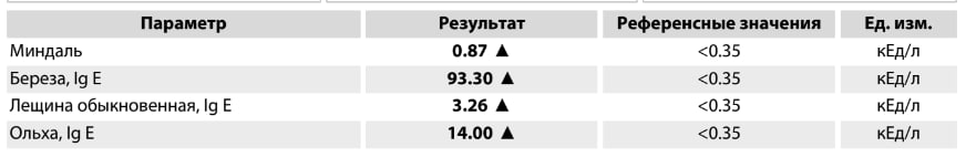 Прикольно берёза в стратосферу улетела