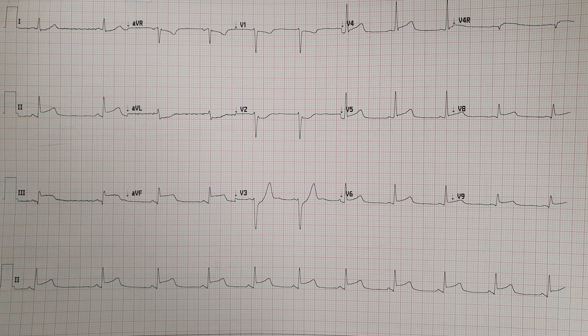 Elad Asher tweet media